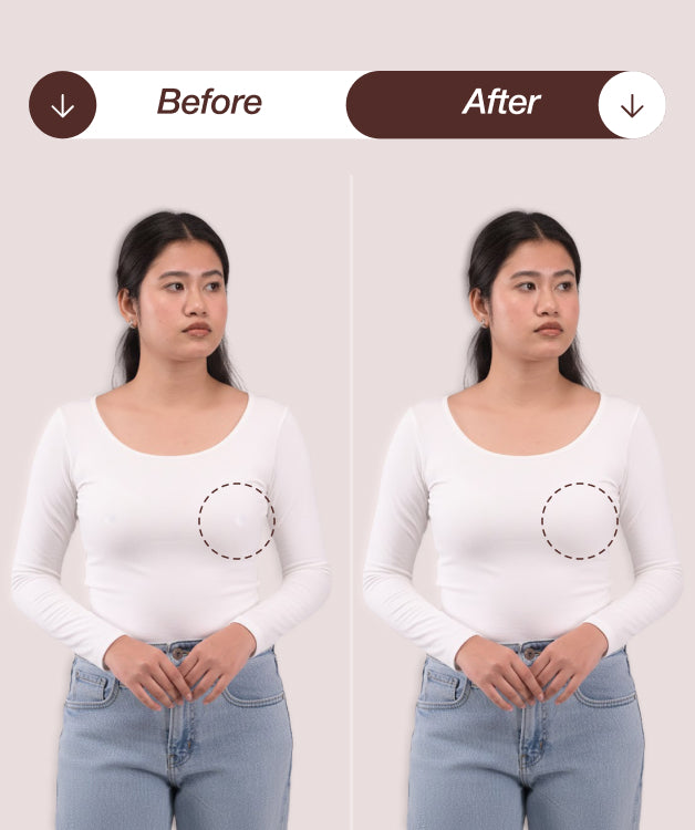 Velomora™  Skin Medical-Grade Nipple Covers | Adhesive-Skin |Glue-Free Design